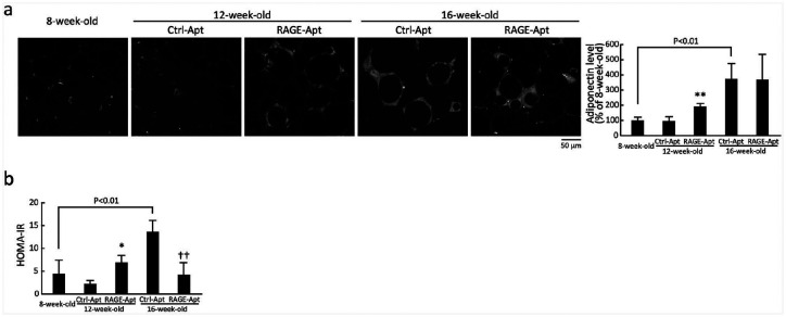 DNA aptamer raised against receptor for advanced glycation end products suppresses renal tubular damage and improves insulin resistance in diabetic mice.