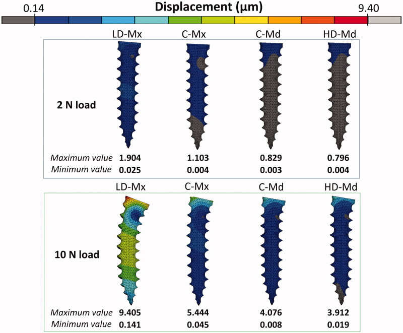 Can maxilla and mandible bone quality explain differences in orthodontic mini-implant failures?