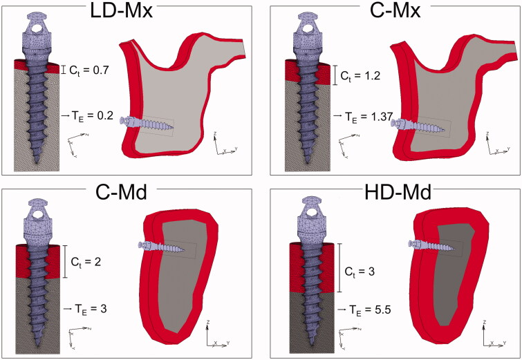 Can maxilla and mandible bone quality explain differences in orthodontic mini-implant failures?