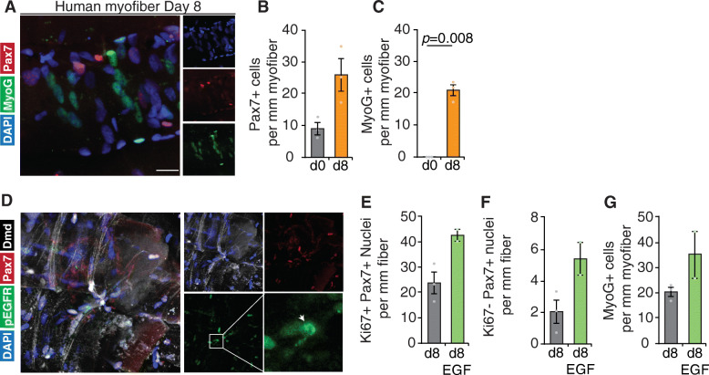 Analysis of human satellite cell dynamics on cultured adult skeletal muscle myofibers.