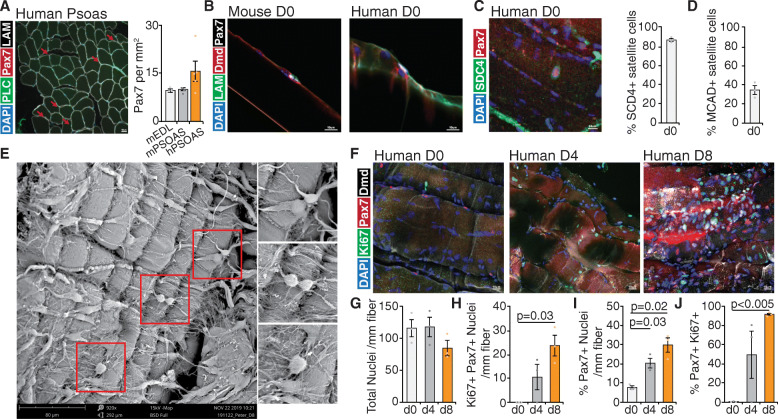 Analysis of human satellite cell dynamics on cultured adult skeletal muscle myofibers.