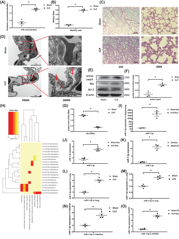 Sepsis plasma-derived exosomal miR-1-3p induces endothelial cell dysfunction by targeting SERP1.