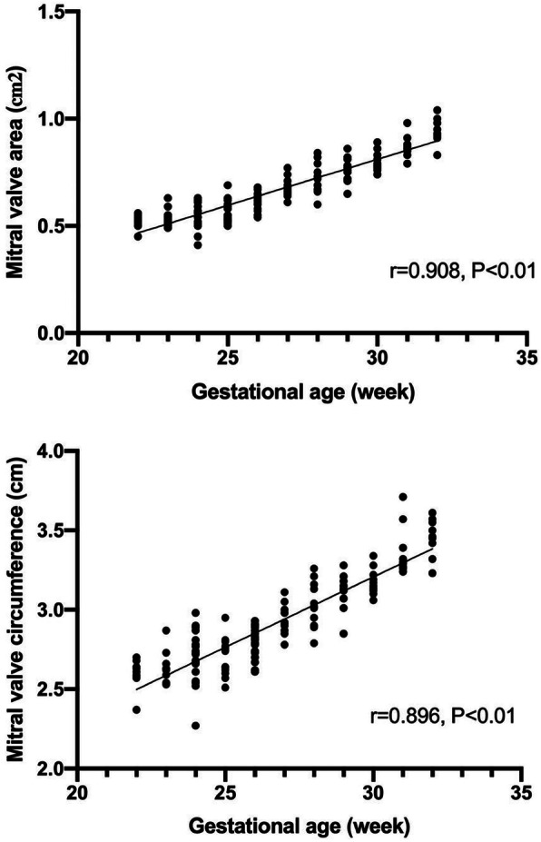 Prenatal evaluation of fetal atrioventricular valves by real-time 4D volume imaging with electronic matrix probe.