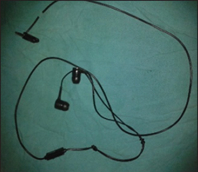 A Self-Insertion of an Uncommon Urethrovesical Foreign Body for Autoerotism.
