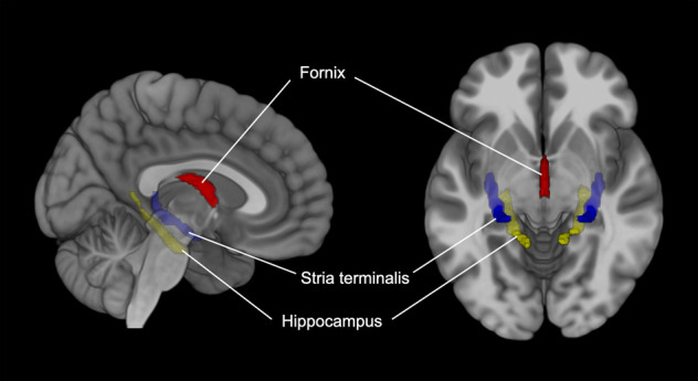 Influence of cytochrome P450 2D6 polymorphism on hippocampal white matter and treatment response in schizophrenia.