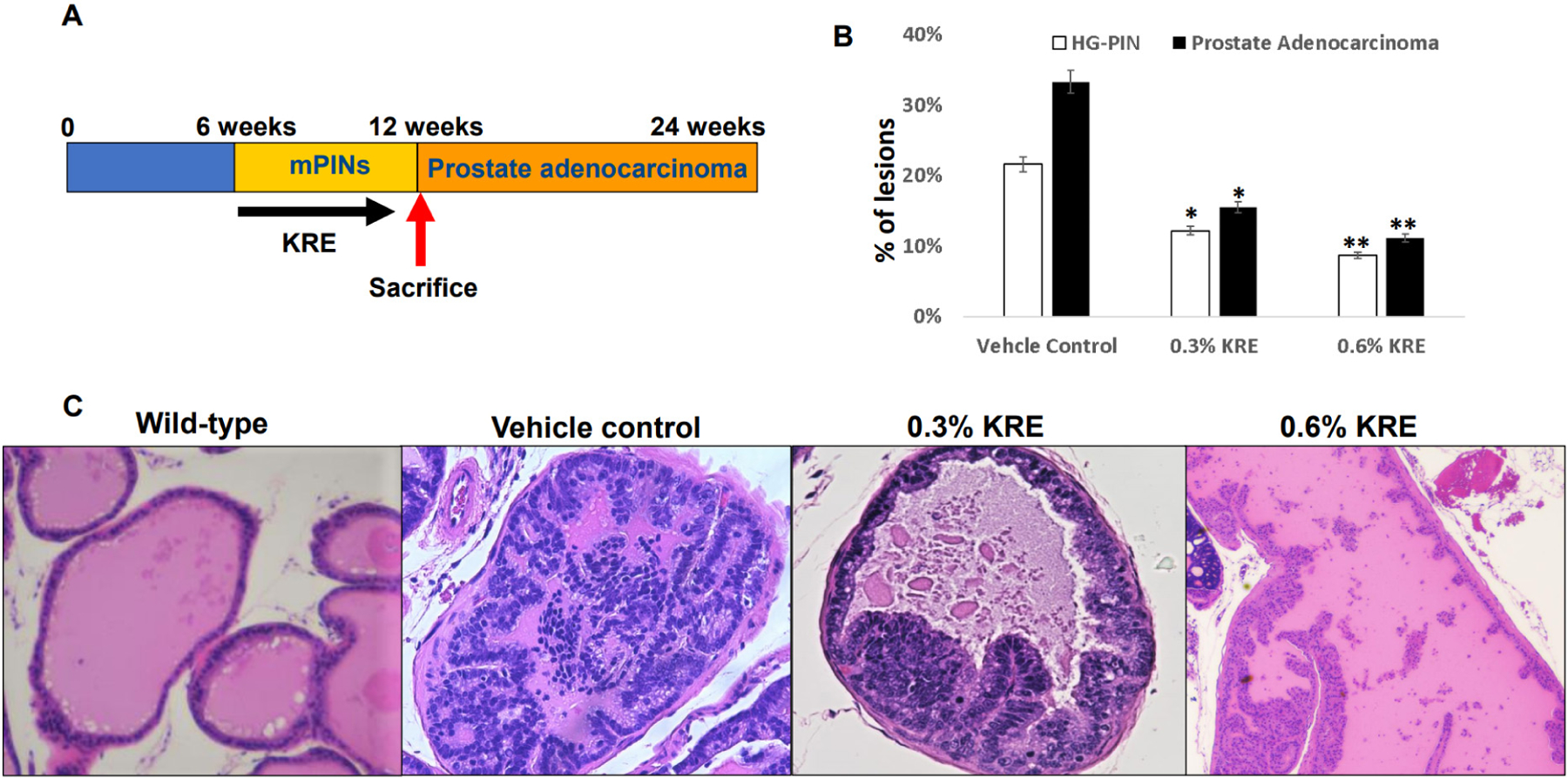 Kava root extracts hinder prostate cancer development and tumorigenesis by involvement of dual inhibition of MAO-A and LSD1.