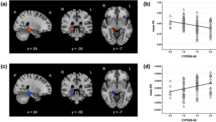 Influence of cytochrome P450 2D6 polymorphism on hippocampal white matter and treatment response in schizophrenia.