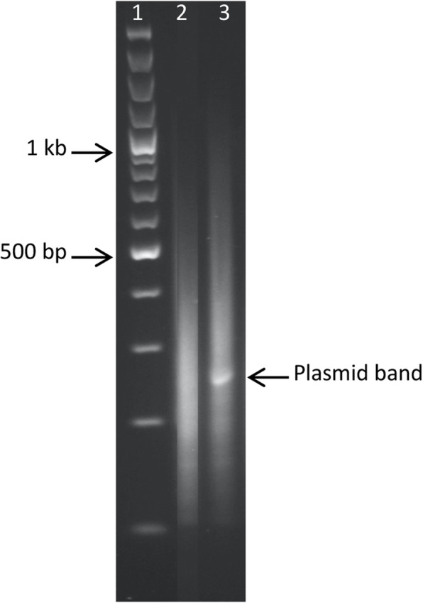 Rationally designed <i>mariner</i> vectors for functional genomic analysis of <i>Actinobacillus pleuropneumoniae</i> and other <i>Pasteurellaceae</i> species by transposon-directed insertion-site sequencing (TraDIS).