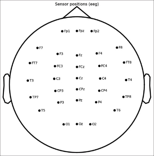 Electroencephalographic Activity in Patients with Claustrophobia: A Pilot Study.