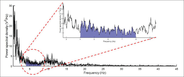 Electroencephalographic Activity in Patients with Claustrophobia: A Pilot Study.