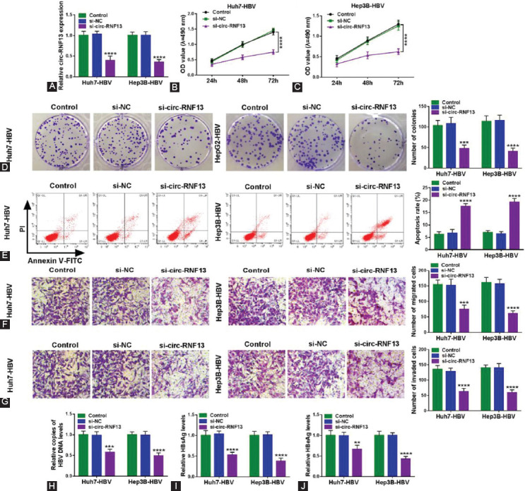 Circ-RNF13, as an oncogene, regulates malignant progression of HBV-associated hepatocellular carcinoma cells and HBV infection through ceRNA pathway of circ-RNF13/miR-424-5p/TGIF2.