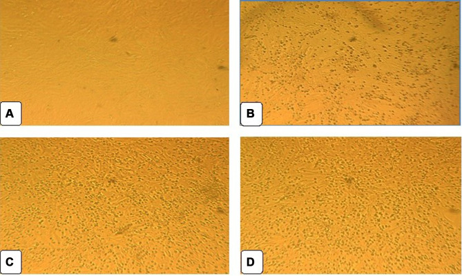 Immunogenicity and Efficacy Evaluation of Vero Cell-Adapted Infectious Bursal Disease Virus LC-75 Vaccine Strain.