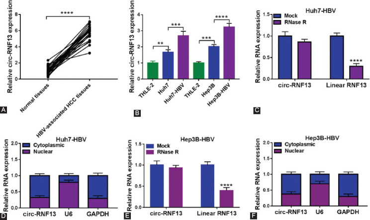 Circ-RNF13, as an oncogene, regulates malignant progression of HBV-associated hepatocellular carcinoma cells and HBV infection through ceRNA pathway of circ-RNF13/miR-424-5p/TGIF2.