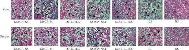 Hydration with Mannitol and Dextrose May Promote Cisplatin-Induced Nephrotoxicity: Test of Five Protocols of Hydration during Cisplatin Therapy in Rat Models.