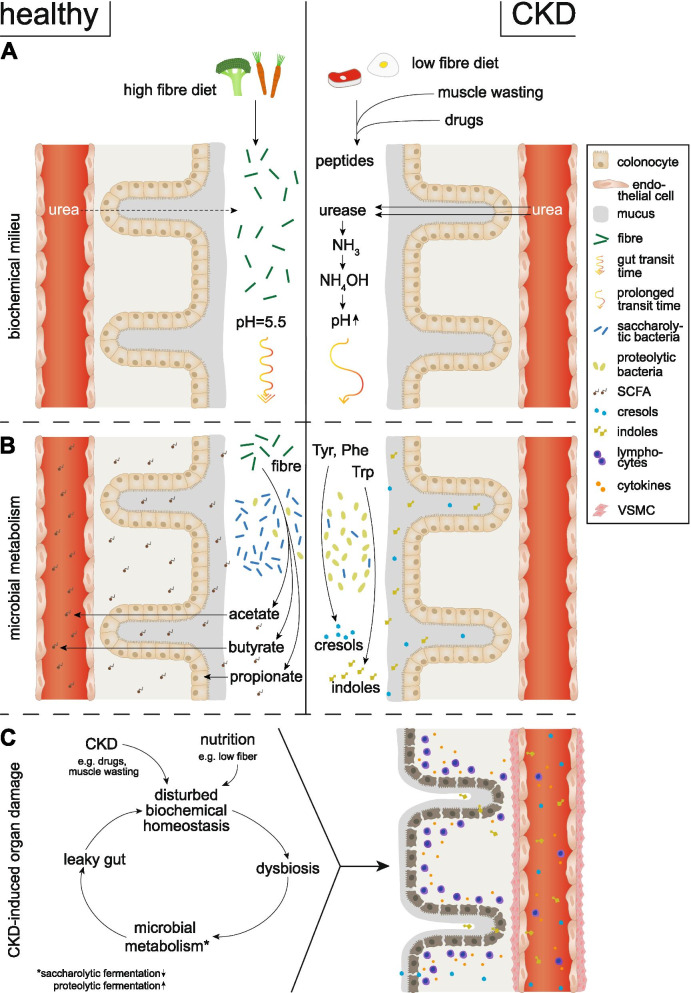 Bacterial metabolites and cardiovascular risk in children with chronic kidney disease.