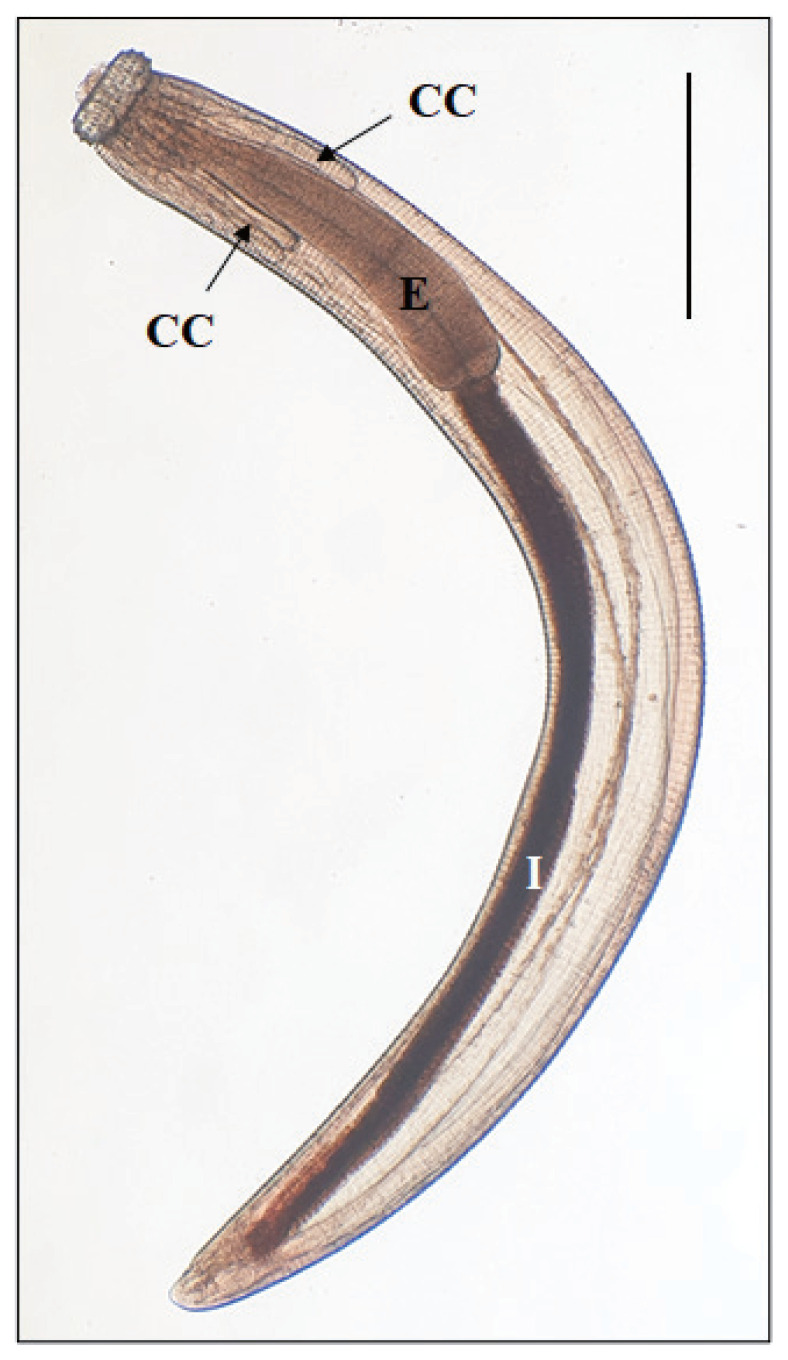 Detection of Gnathostoma spinigerum Advanced 3rd-Stage Larvae in the Chinese Edible Frog, Hoplobatrachus rugulosus, from Local Markets in Phnom Penh, Cambodia.