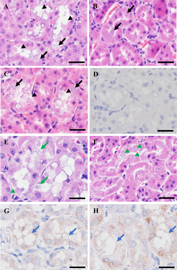 Karnovsky's fixative prevents artifacts appearing as vacuolation derived from tissue processing in kidneys treated with antisense oligonucleotide.