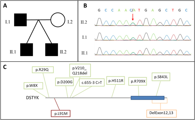 Exome sequencing implicates a novel heterozygous missense variant in DSTYK in autosomal dominant lower urinary tract dysfunction and mild hereditary spastic paraparesis.