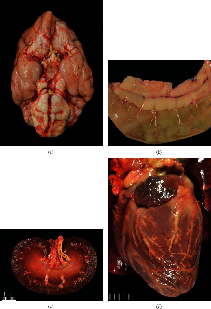 Myxedema Coma and Acute Hepatopathy in a Dog with Severe Atherosclerosis.