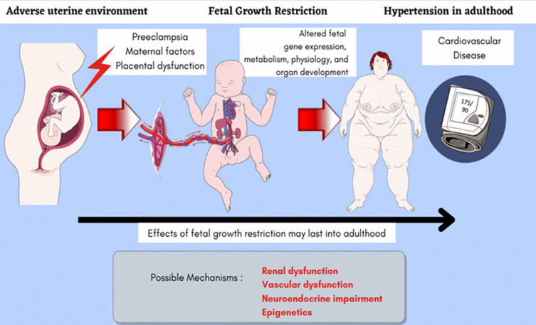 Insights into the Mechanisms of Fetal Growth Restriction-Induced Programming of Hypertension.