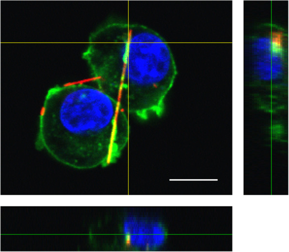 Recent progress and perspectives on the mechanisms underlying Asbestos toxicity.