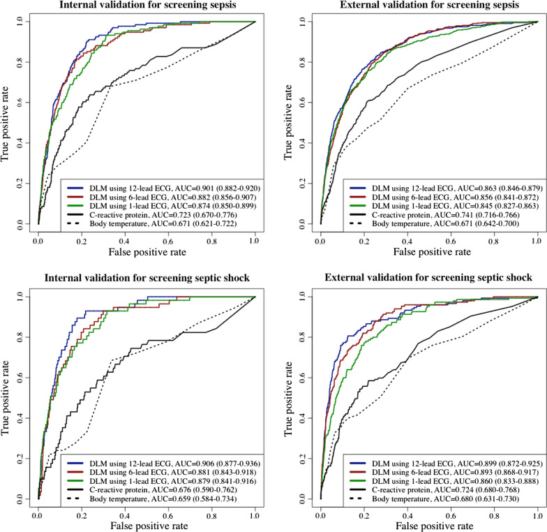 Deep-learning model for screening sepsis using electrocardiography.