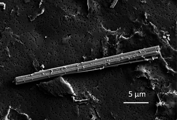 Recent progress and perspectives on the mechanisms underlying Asbestos toxicity.