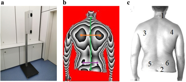 Standard reference values of the upper body posture in healthy male adults aged between 31 and 40 years in Germany-an observational study.