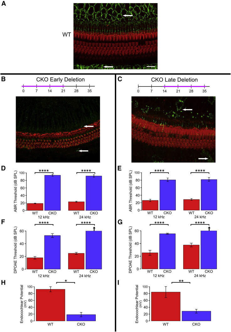 <i>GJB2</i> gene therapy and conditional deletion reveal developmental stage-dependent effects on inner ear structure and function.
