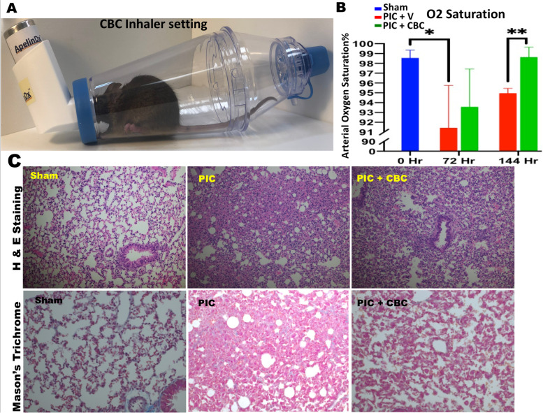 A potential role for cannabichromene in modulating TRP channels during acute respiratory distress syndrome.