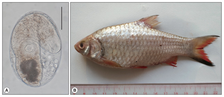 Prevalence and Intensity of Opisthorchis viverrini Metacercarial Infection in Fish from Phnom Penh, Takeo, and Kandal Provinces, Cambodia.