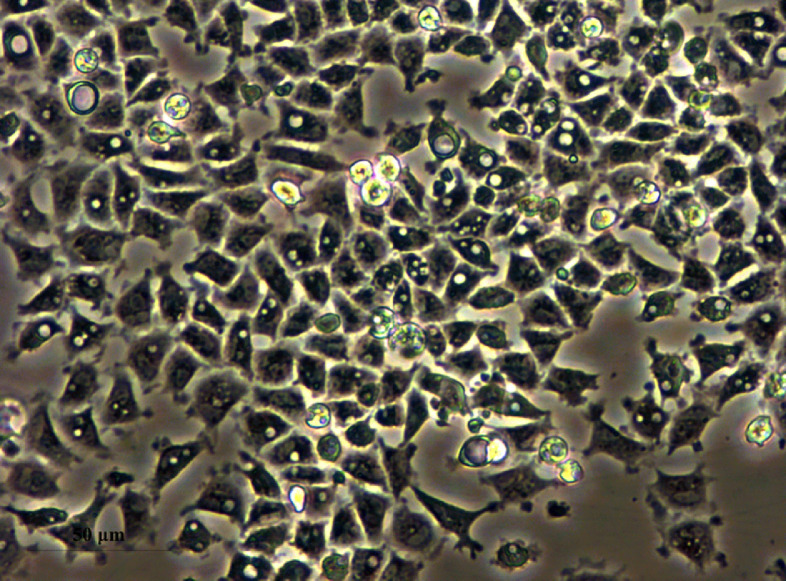 In vitro study of sodium butyrate on soyasaponin challenged intestinal epithelial cells of turbot (Scophthalmus maximus L.) refer to inflammation, apoptosis and antioxidant enzymes