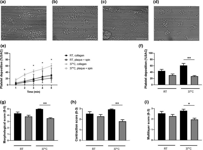 Characterization of Atherosclerotic Plaque Coating for Thrombosis Microfluidics Assays.