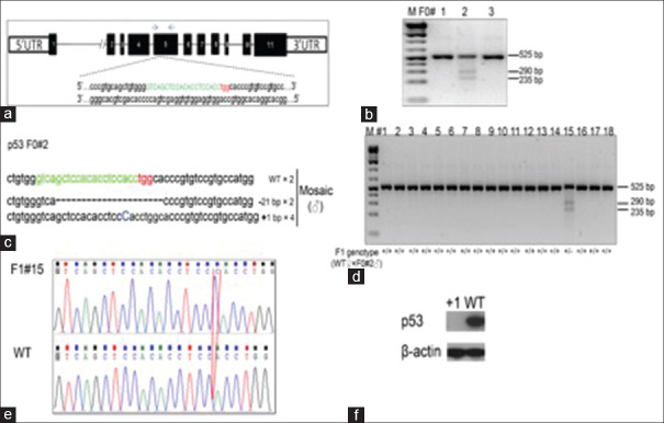 Cancer spectrum in TP53-deficient golden Syrian hamsters: A new model for Li-Fraumeni syndrome.