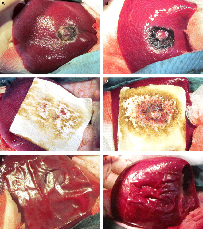 Safety and efficacy of sFilm-FS, a novel biodegradable fibrin sealant, in Göttingen minipigs.