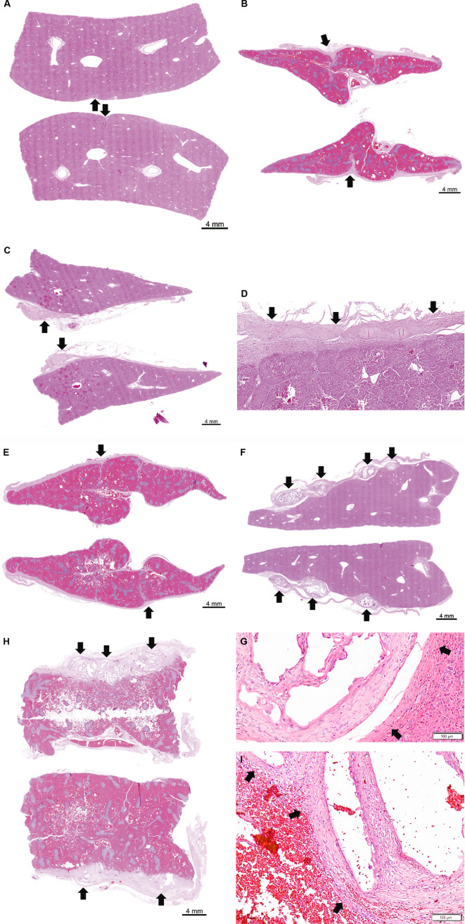 Safety and efficacy of sFilm-FS, a novel biodegradable fibrin sealant, in Göttingen minipigs.