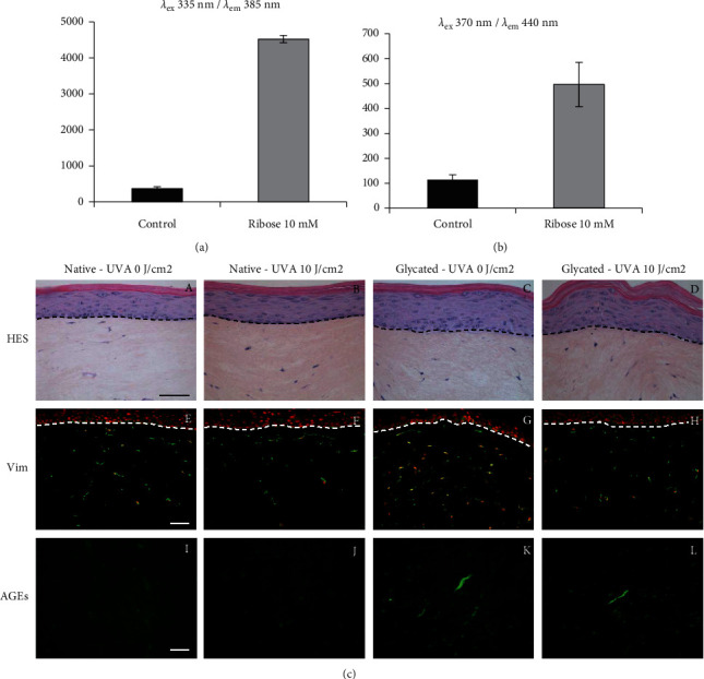 UVA Exposure Combined with Glycation of the Dermis Are Two Catalysts for Skin Aging and Promotes a Favorable Environment to the Appearance of Elastosis.