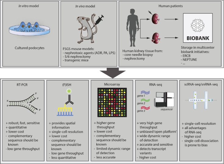 Deconvolution of Focal Segmental Glomerulosclerosis Pathophysiology Using Transcriptomics Techniques.