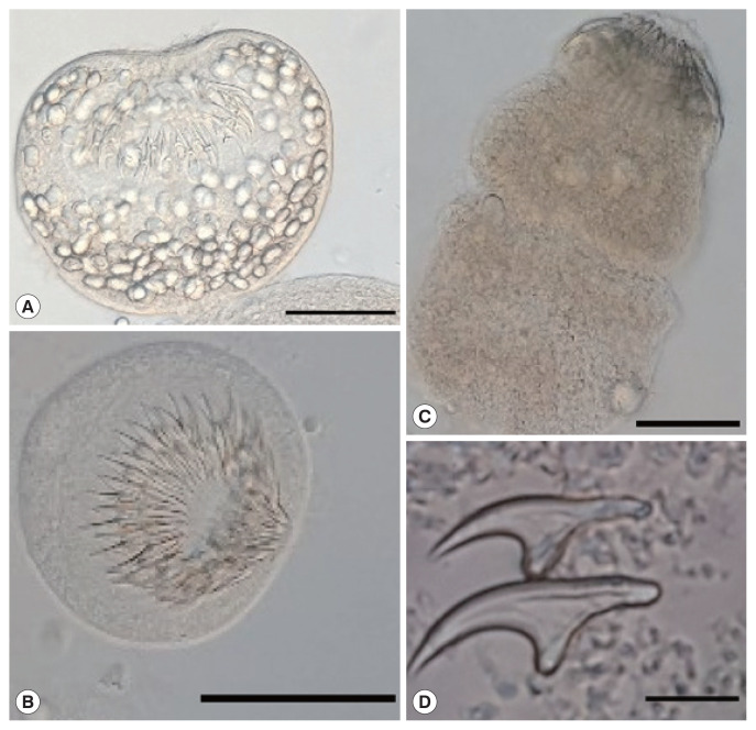 Genotypes of Echinococcus Species from Cattle in Tanzania.