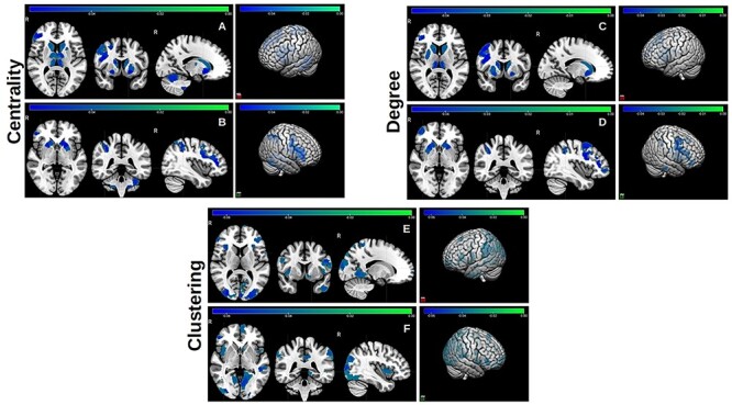 Shorter Duration and Lower Quality Sleep Have Widespread Detrimental Effects on Developing Functional Brain Networks in Early Adolescence.