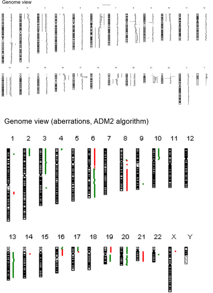 Unusual course of disease and genetic profile in Li-Fraumeni syndrome-associated osteosarcoma - a case report.