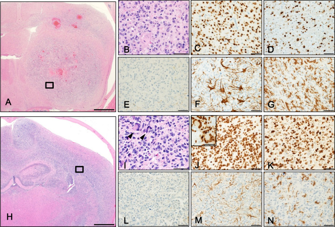 Genome editing of <i>Nf1, Pten,</i> and <i>Trp53</i> in neonatal mice induces glioblastomas positive for oligodendrocyte lineage transcription factor 2.