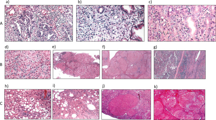 Contribution of toxicologic pathologists for the safety of human health in biomedical research-past, present, and future of the JSTP.