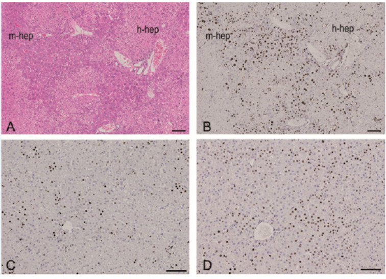 Application of humanized mice to toxicology studies: Evaluation of the human relevance of the mode of action for rodent liver tumor formation by activators of the constitutive androstane receptor (CAR).