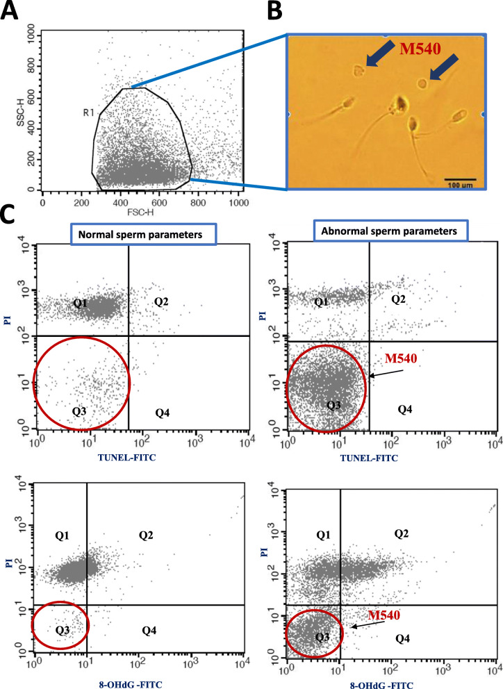 Apoptotic M540 bodies present in human semen interfere with flow cytometry-assisted assessment of sperm DNA fragmentation and oxidation.