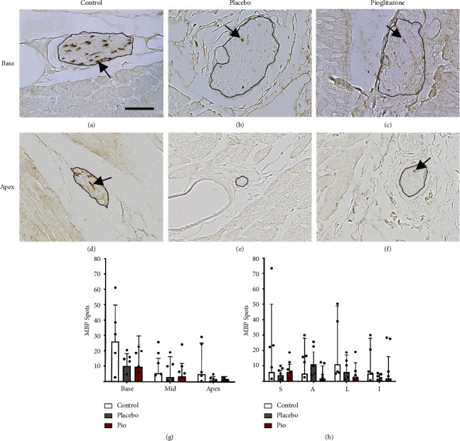 Myelin Basic Protein and Cardiac Sympathetic Neurodegeneration in Nonhuman Primates.