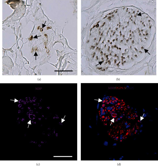 Myelin Basic Protein and Cardiac Sympathetic Neurodegeneration in Nonhuman Primates.