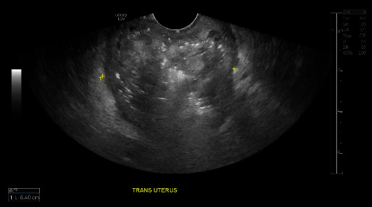 Medical Management of Pyometra in the Delayed Postoperative Period.