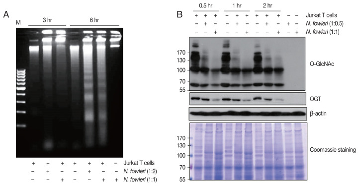 Naegleria fowleri Induces Jurkat T Cell Death via O-deGlcNAcylation.