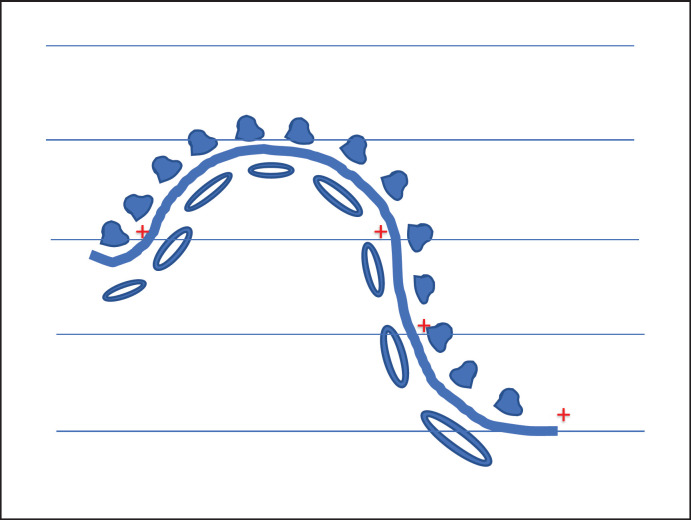 An Introduction to Stereology with Applications to the Glomerulus.